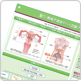 IC下敷き：進行・再発子宮体がんと診断された患者さんへ（LEN1415）